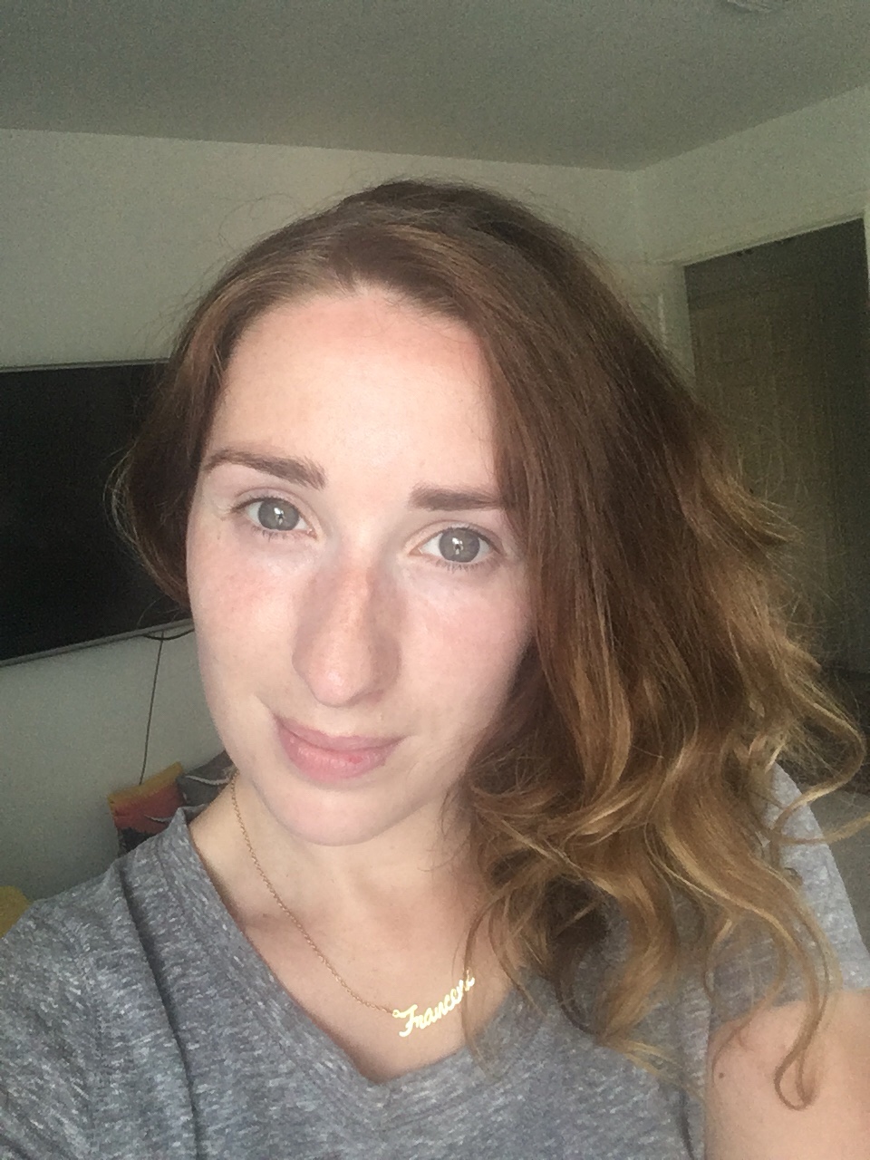 Journey To Better&nbsp;Skin