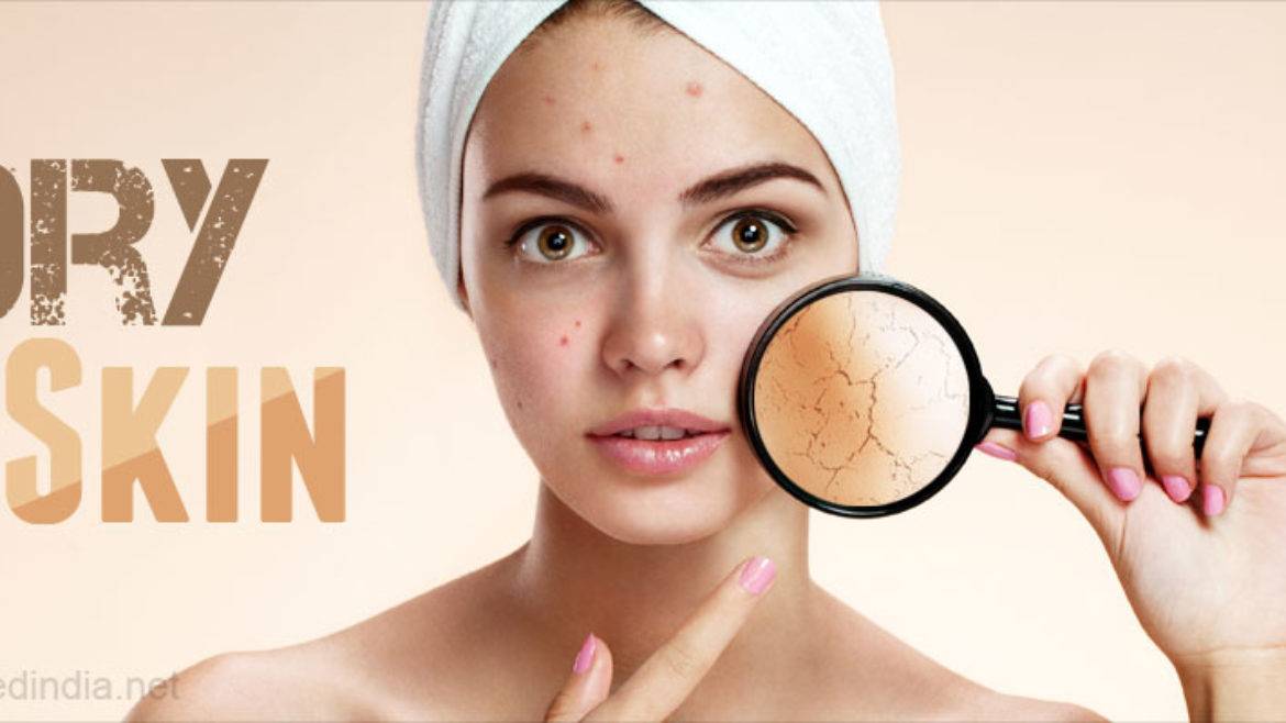 dry-skin-xerosis-1170x658